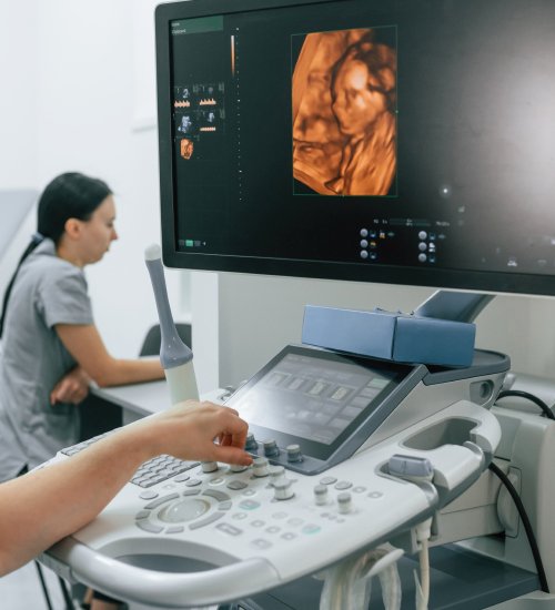early pregnancy scan leicester